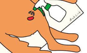 床ずれ褥瘡-パッドによる湿潤療法②